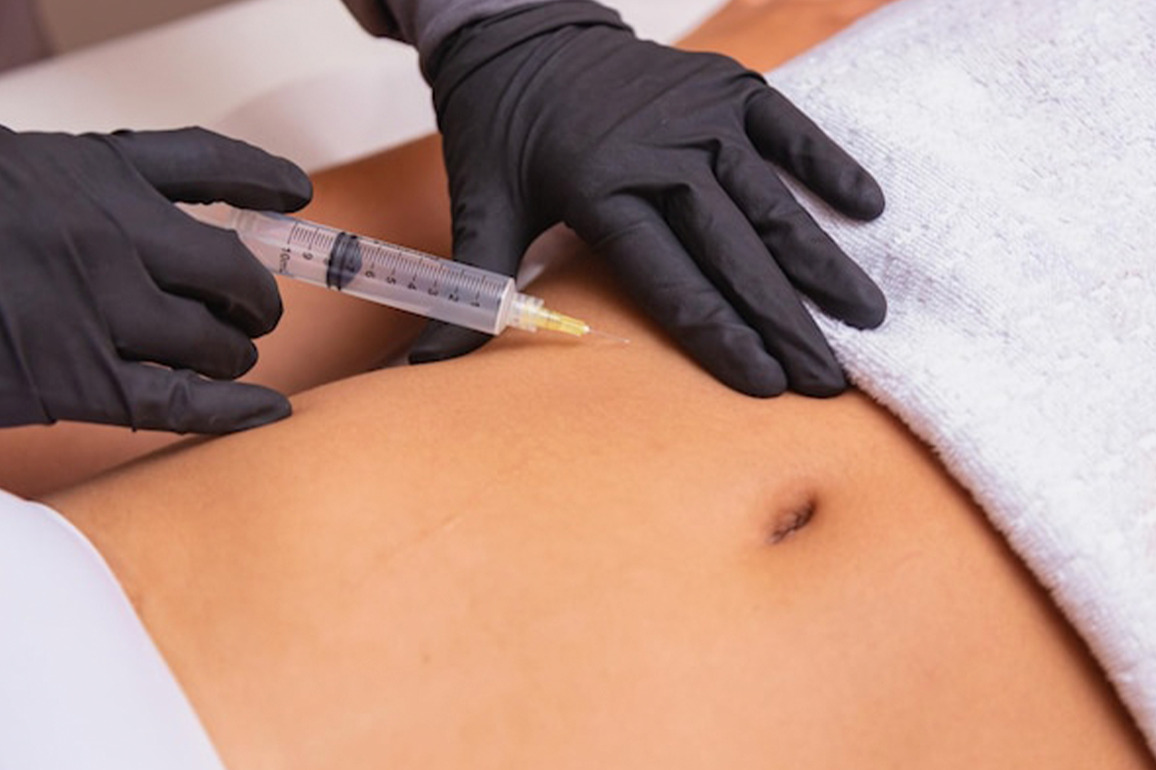 Ozonioterapia estética clínica Serenna