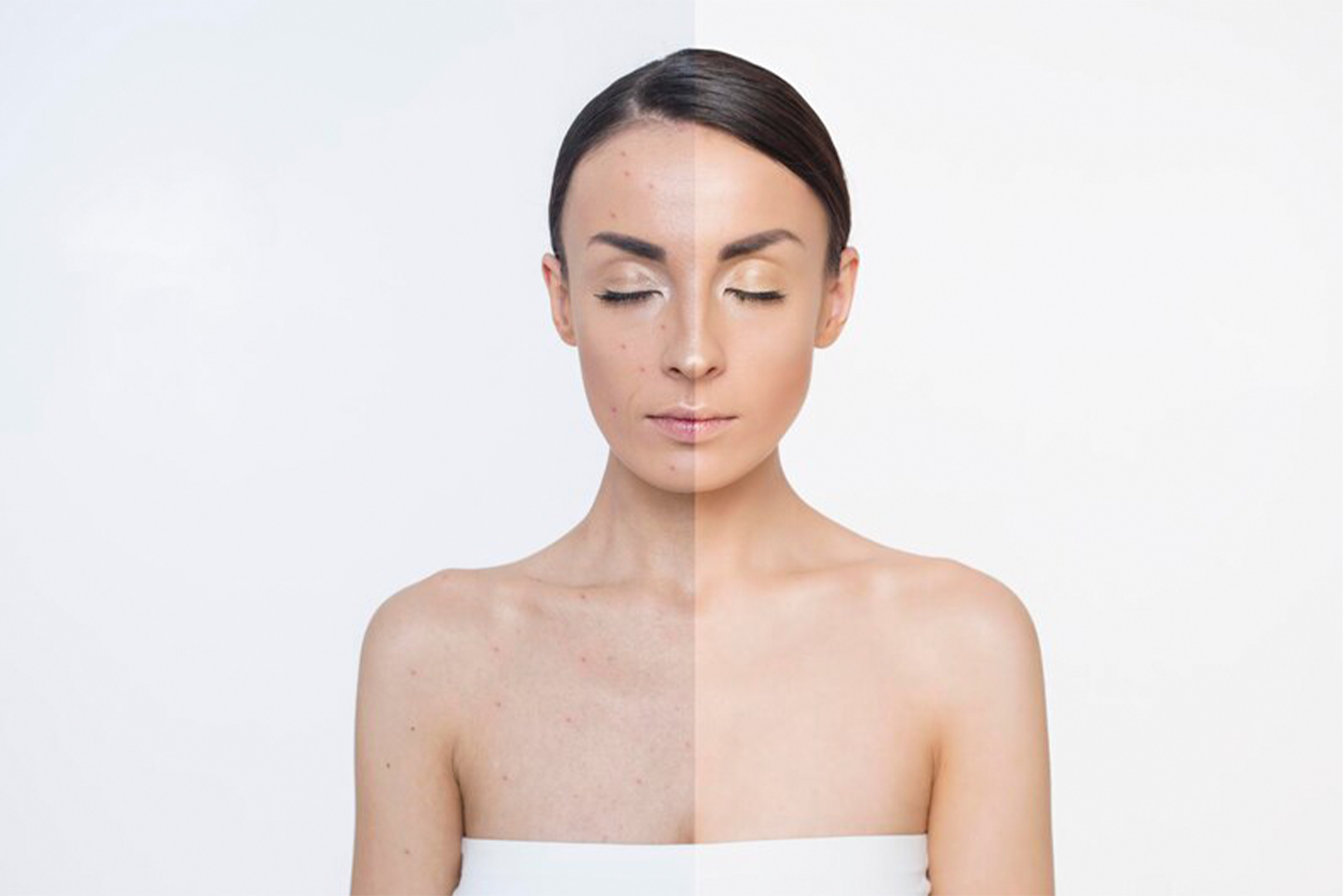Skinbooster Clínica Serenna